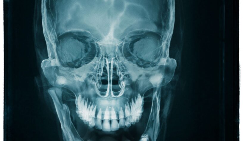 Burger King gerçekten büyük-campaigntr