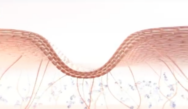 NIVEA cilt lekelerinden yakınanlara çözümle geldi-campaigntr